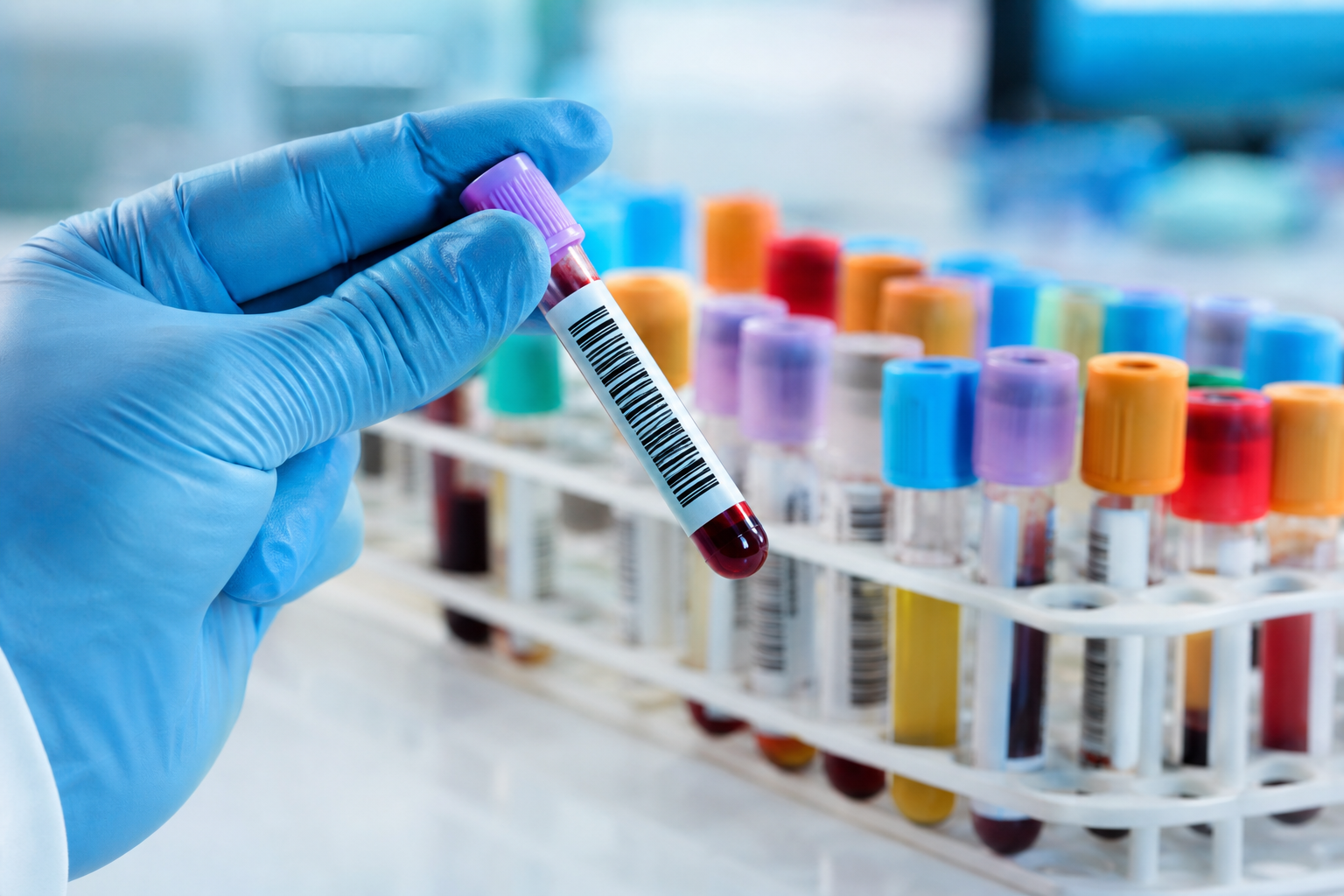 Laboratório de Análises Clínicas